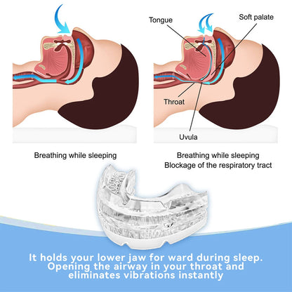 Snooze Guard Anti Snoring Mouthpiece | Adjustable, Eco-Friendly Design 1